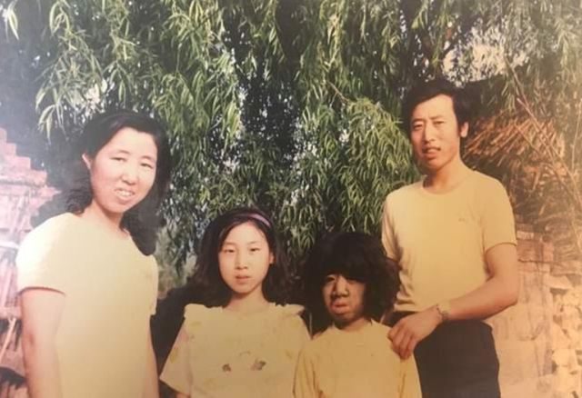 FB体育 FB体育平台“第一毛孩”于震寰：出生就被研究42岁娶90后娇妻如今怎样了(图11)