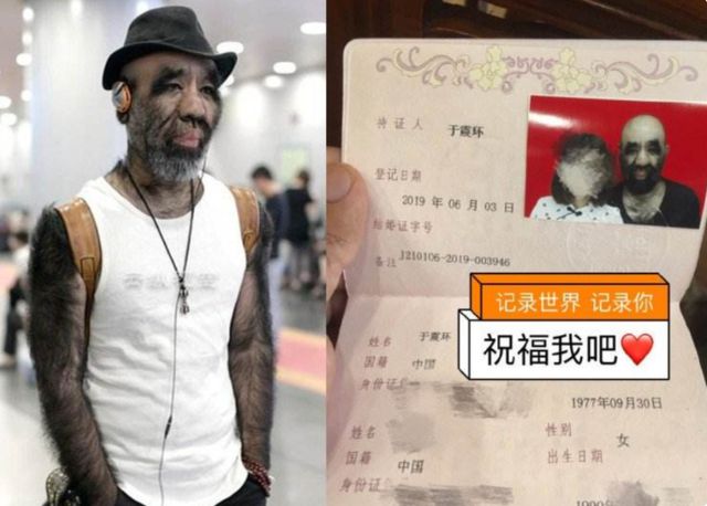 FB体育 FB体育平台“第一毛孩”于震寰：出生就被研究42岁娶90后娇妻如今怎样了(图1)