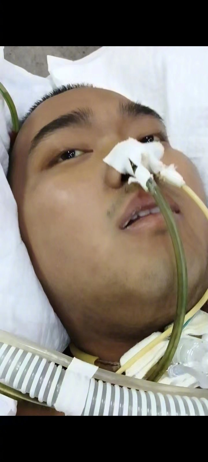 黑龙江肇东高三学生朱思赫突发急性胰腺炎 妈妈：卖房子也要救他！FB体育 FB体育平台(图1)